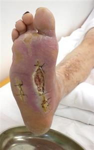 Uninstall Spyware Android